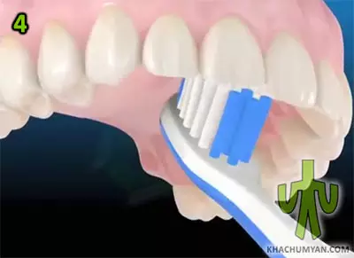 The position of the brush on the inside of the upper teeth