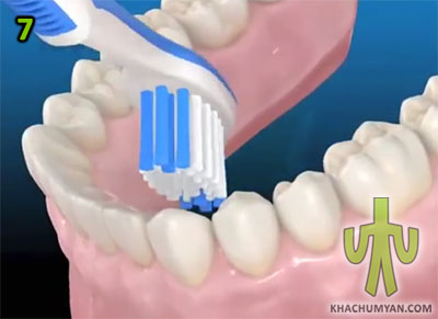 Ատամի խոզանակի դիրքը ստորին ատամների ներսային մակերեսը լվանալիս