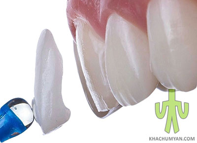 Tooth restoration by orthopedic methods