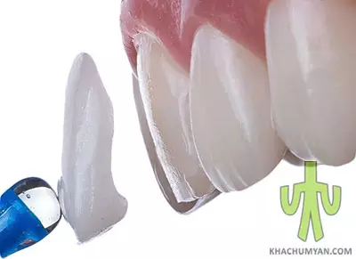 Tooth restoration by orthopedic methods
